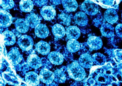 Коронавірусну інфекцію підозрюють у чотирьох мешканців Сумщини 